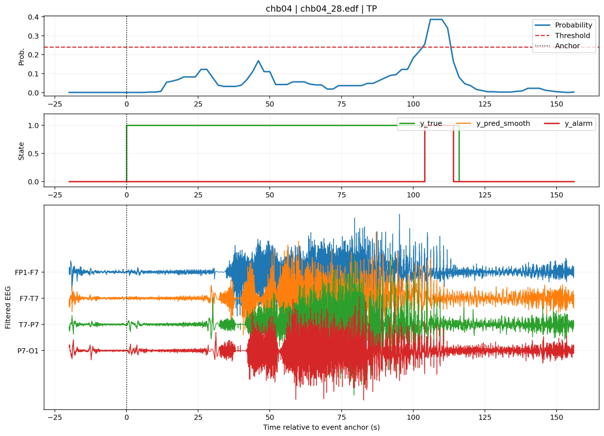 Delayed true-positive EEG detection example